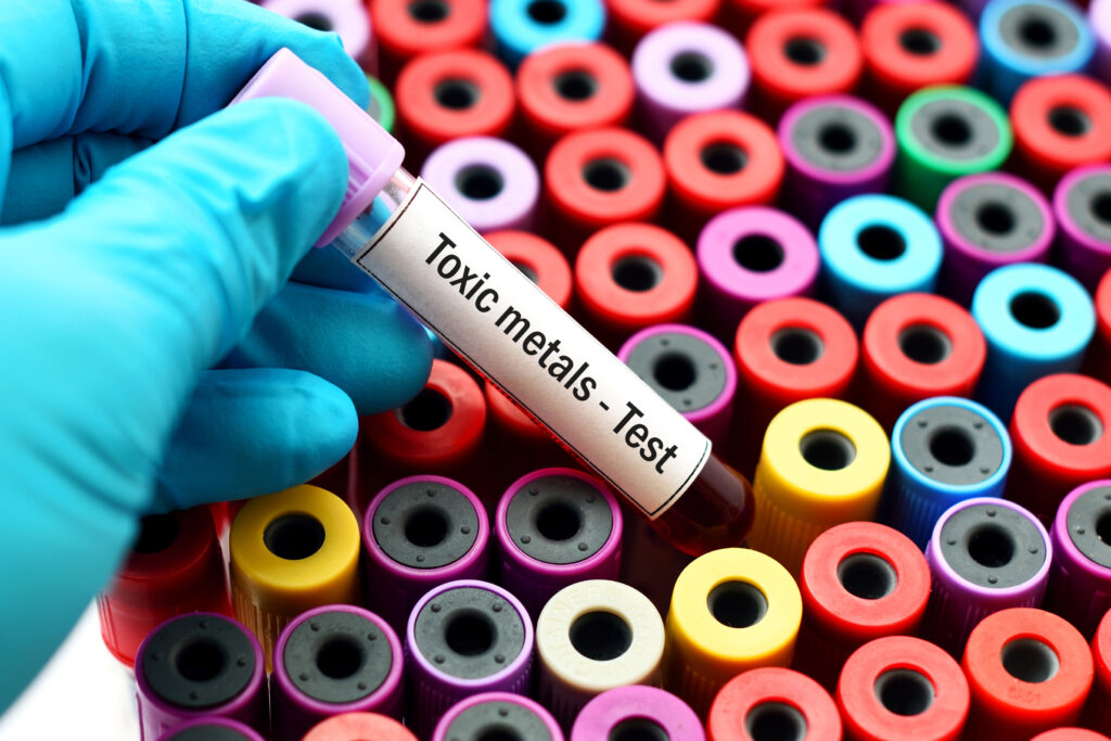 Heavy Metal Test Toxicity