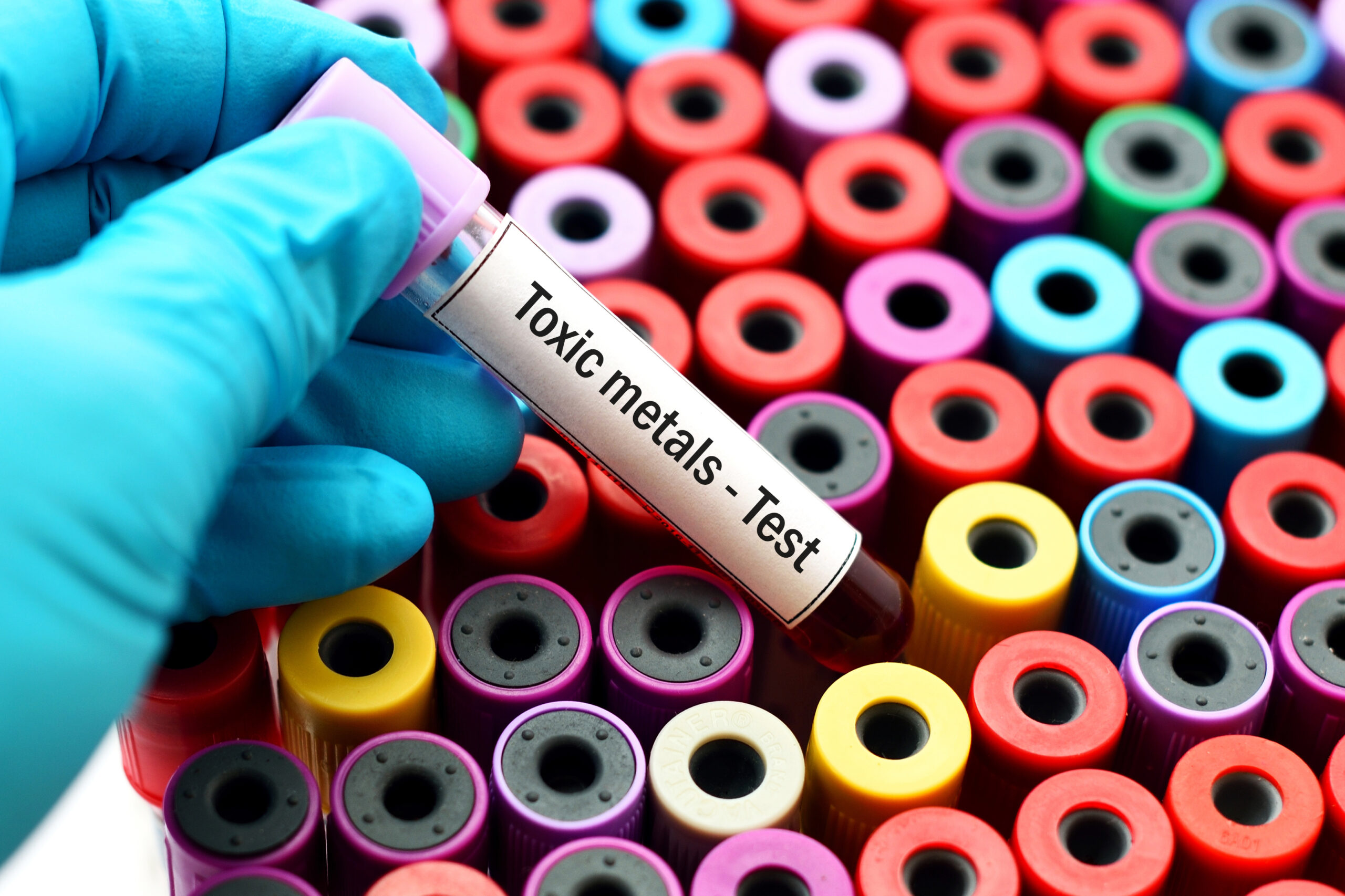 Heavy Metal Test Toxicity
